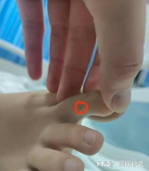 三亚蛇咬死人后续家属曝全过程俩医院恐担责女孩身份不一般(图15)
